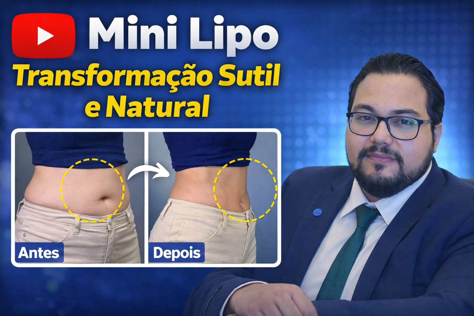 Mini Lipo